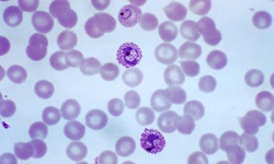 Plasmodium vivax